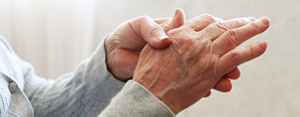 Opioids Don’t Have to be the Answer for Arthritis Pain