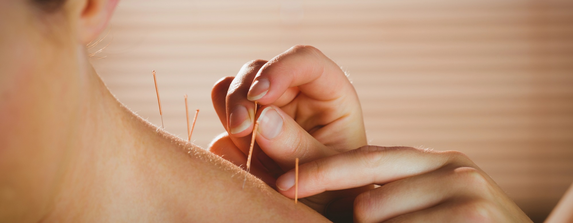 How Acupuncture Eases Anxiety
